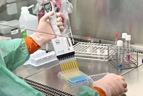 Auch am Universitätsklinikum Homburg können im Verdachtsfall Proben auf eine Infektion mit dem Coronavirus untersucht werden kön