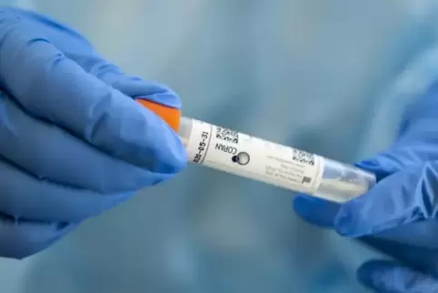 Nur von den acht Schülern mit Erkältungssymptomen wurden Proben genommen.
