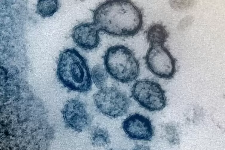 Das Coronavirus SARS-CoV-2 unter dem Elektronenmikroskop.